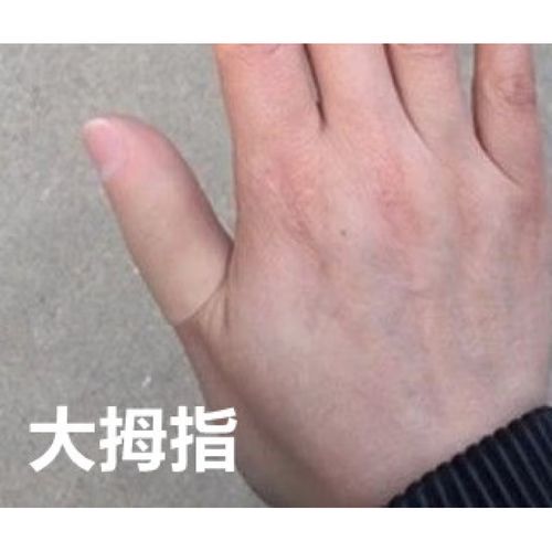 假肢手指 假肢手指假手指 断手指美容手指量身定做假脚趾假手指头 大