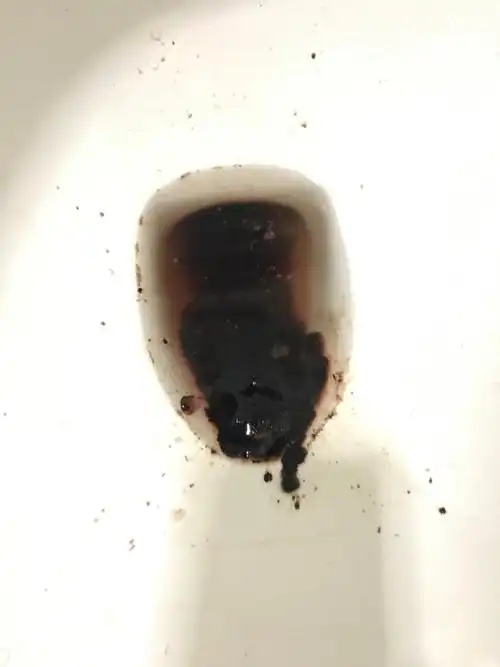 这个是胃出血吗?今天感觉肚子不适,上完厕所发现大便是这样的,冲开