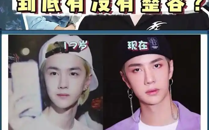 王一博整容王一博长得像小吴