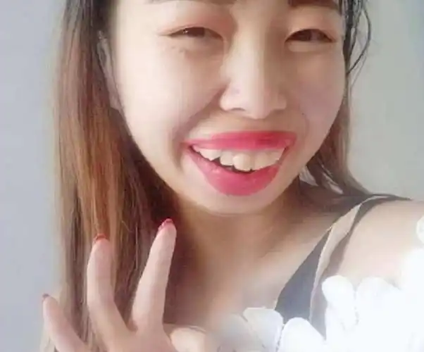 刷小视频的一定非常熟悉,大嘴,厚嘴唇,龅牙,小眼睛,简直丑女标配啊