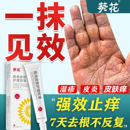 阴囊特潮湿成男人专用肛门痒阴周部效去根私处真菌感染医用皮癣药肤