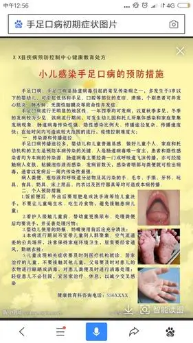 一般为3～6天,平均4天. 手足口病患儿多久可来幼儿园?