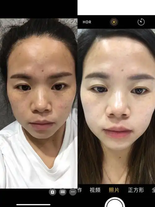 蓓悠清美白淡斑效果怎么样?真的很好吗?