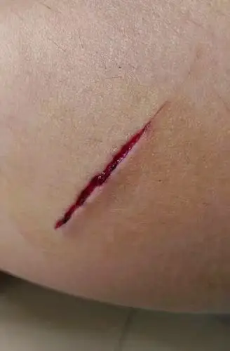 深度揭秘"挨打"之谜!