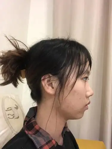 想问问姐妹我的侧脸问题究竟在哪呢