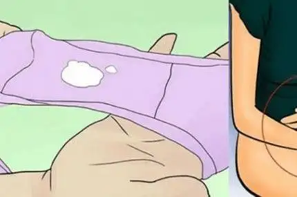 内裤发黄发硬分泌物像豆腐渣这些不正常的信号你注意过吗