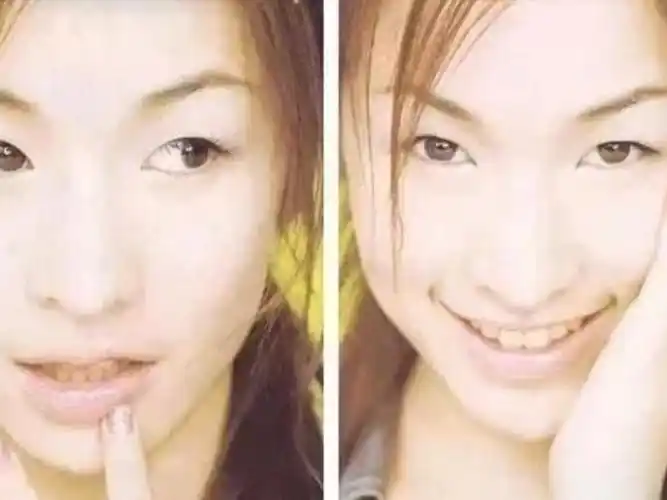 恋爱小天才萧亚轩的颜值变化史