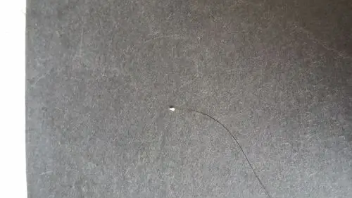 掉的头发都是这种发根有一点白的,这种事毛囊吗?