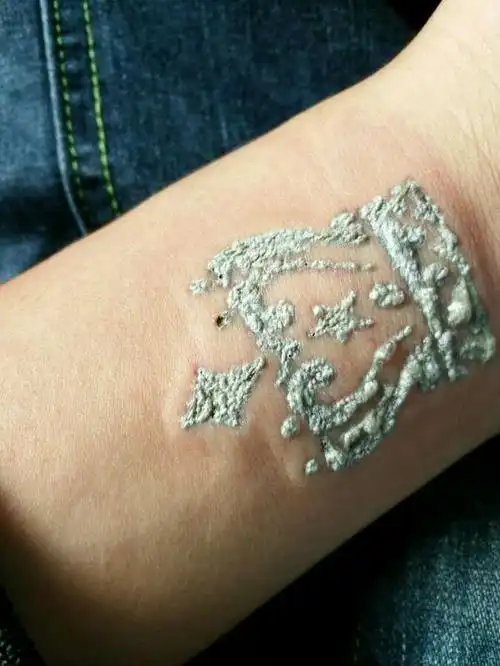 6个洗纹身后的效果图片