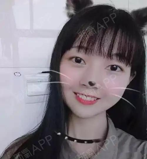 虎牙,拔了四颗牙.一年半,牙齿整齐了,总之我不后悔戴牙套