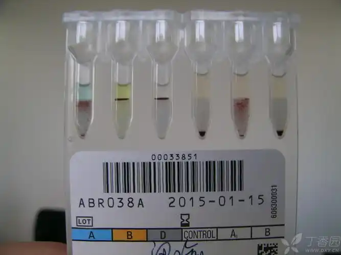 检测对象为男性,24岁,非患者,为自愿检测血型