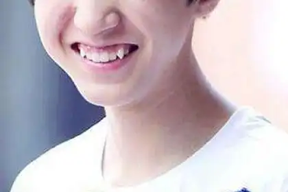 长虎牙的人怎么样 究竟好不好呢