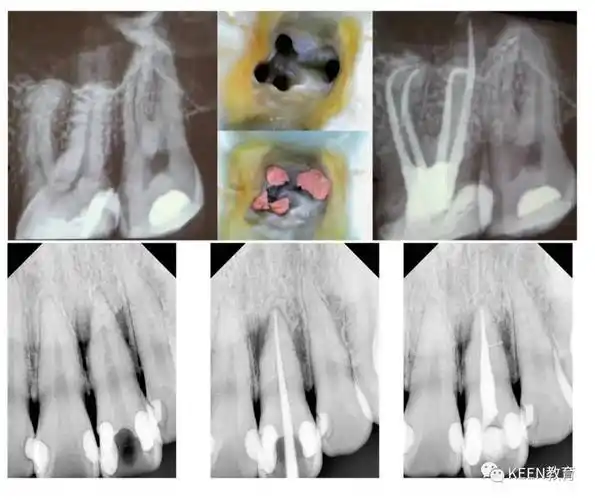 向下滑动查看课程大纲备注:自带离体牙数颗(前牙,前磨牙,磨牙)11.