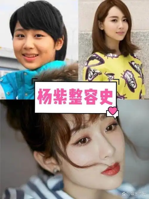 无论杨紫是否承认整容,她的现在的成就离不开她出色的外貌.