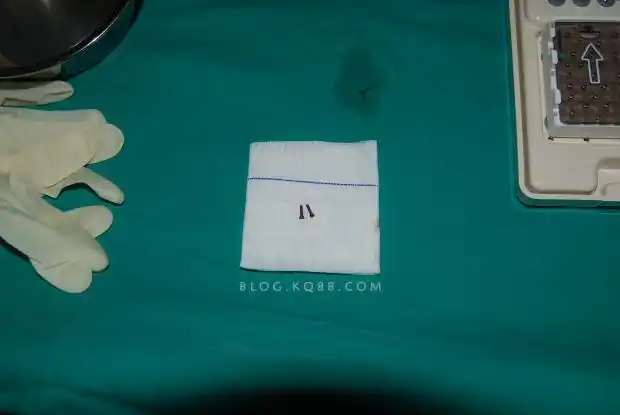 吻合器钛钉 医保钛钉