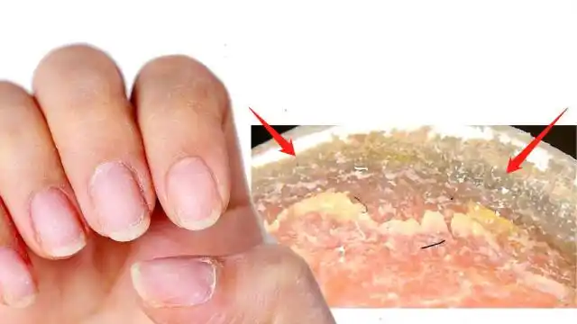 显微镜放大100倍看手指甲,真的太可怕了,看完再也不敢乱啃指甲了!