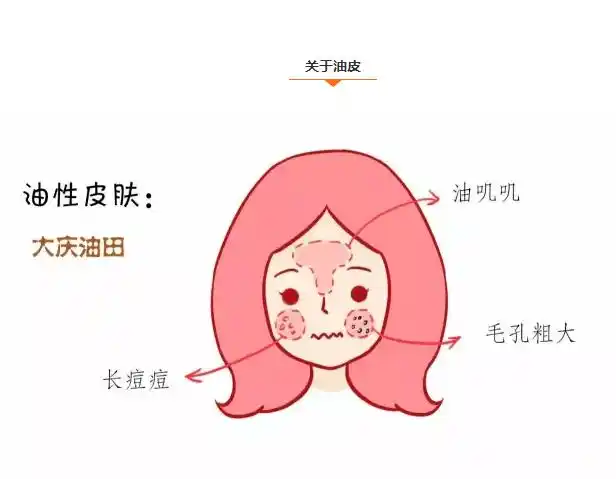 夏季肌肤易出油,痘痘肌肤应该怎么护理?_皮肤