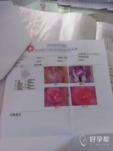 哎,今天去检查吓我一身冷汗,原来这么严重