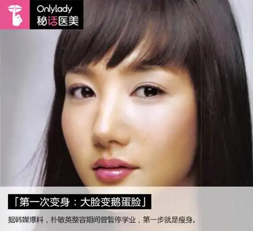 整容最厉害的韩国女星朴敏英终成大美女