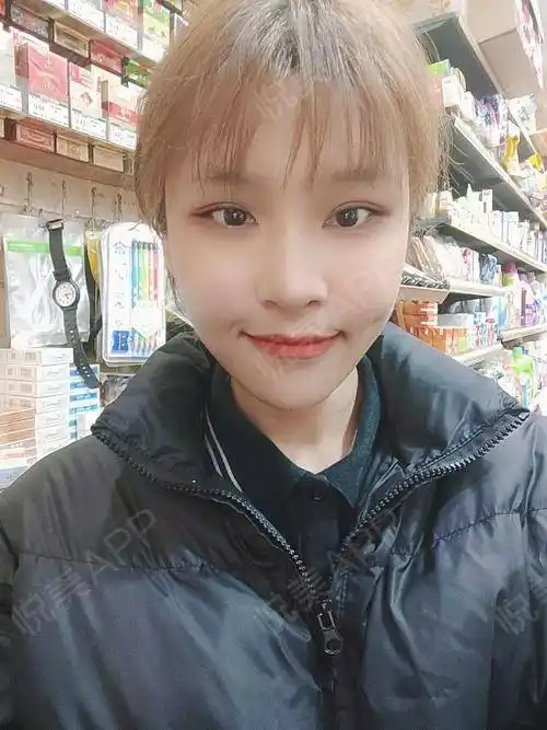 时间过得真快,做完自体脂肪填充已经快半个月啦,目前恢复得很好,槐揪