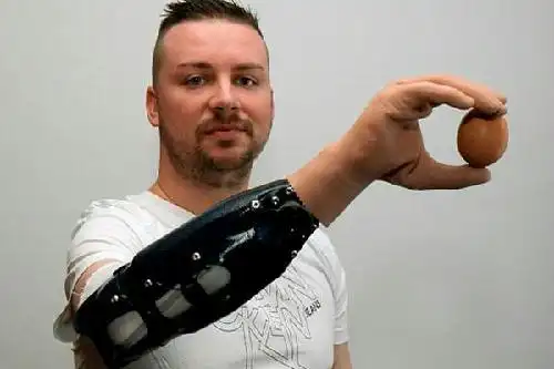 右前臂假肢价格