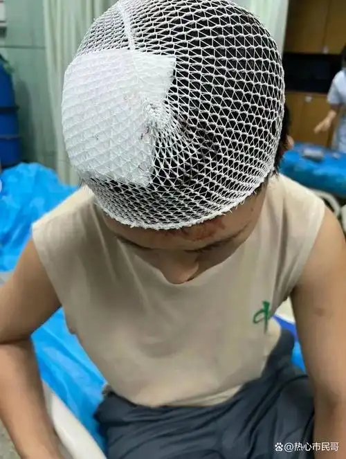 猖狂!女孩疑因低价摆摊遭同行殴打