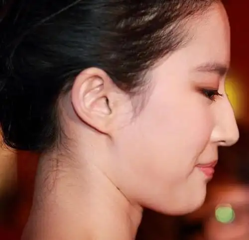 每个人的面孔都是独一无二的,娱乐圈好多女明星都有驼峰鼻,比如