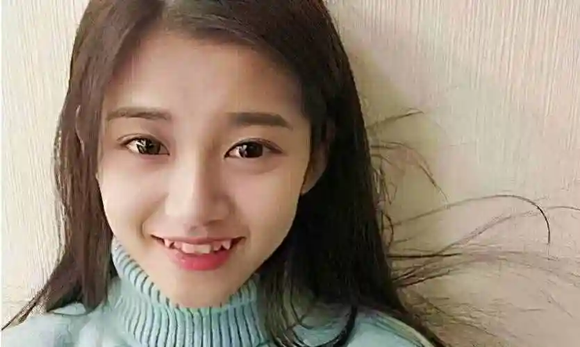 虎牙是什么虎牙是病吗