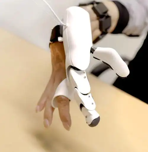 假肢机械手指,韩国科研机构发明用于截肢患者的智能机械手指