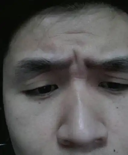 山根有横纹是否会影响个人财运?掌握化解技巧