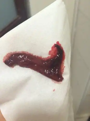 像肉一样.小肚子猛的一紧,下面就有很大一块血滑下来.