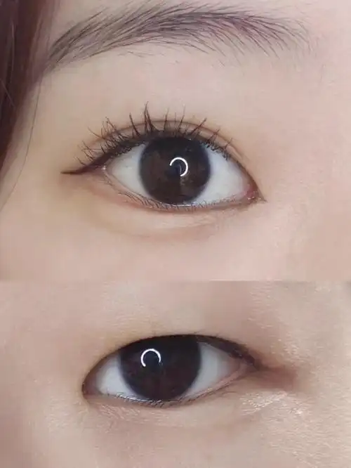 单眼皮肿眼泡贴双眼皮教程