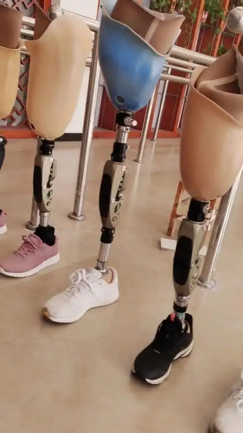 五个人两条腿,八条假肢