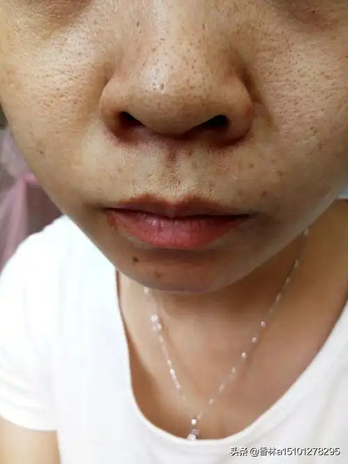 头条问答 - 油性皮肤,毛孔粗大用什么面霜比较好,预算300以内?