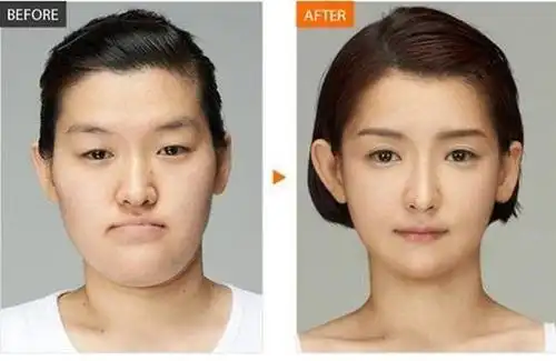 一组整容前后的对比照片 看后无法直视韩国人
