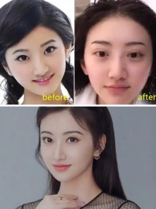 就连明星也纷纷效仿 你有被眼皮封印颜值吗71 还好景甜美商没有那么