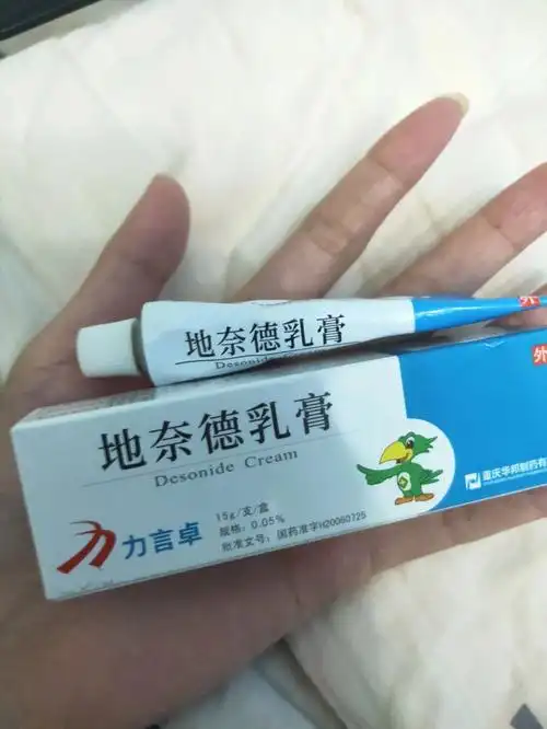 我已经可以自己看病了刚才想涂一下医生开的乳膏就拿出来还是觉得很