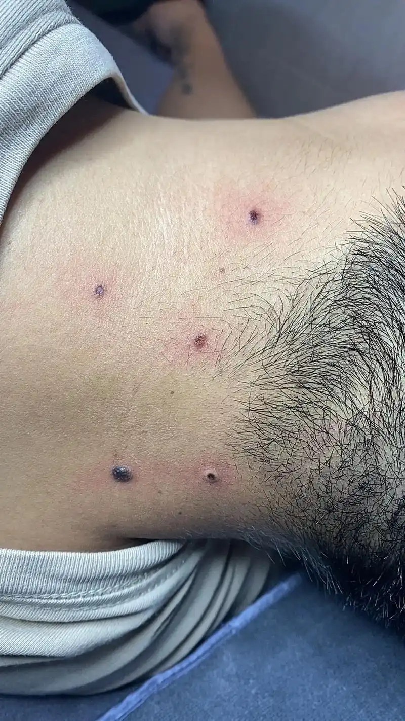 坏痣必除[胜利]就不要再说背上和侧脸长痣,你看不见无所谓了