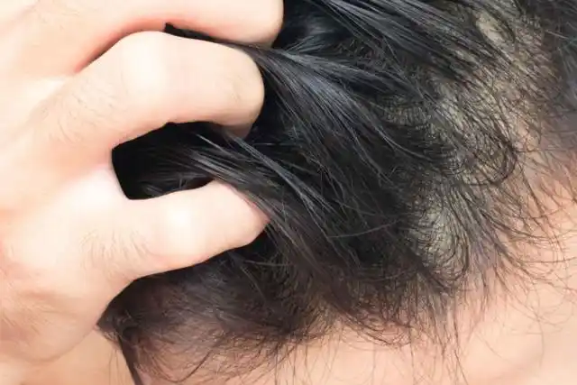 也没有弹性,这类发质属于干发质;中性发质:洗过头24-48小时后,头皮