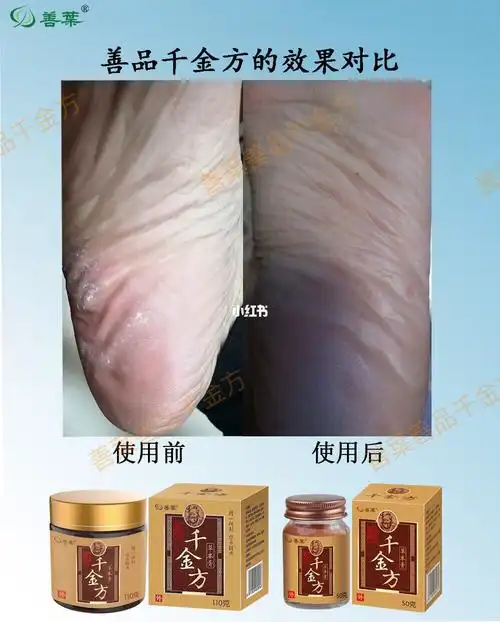 善叶善品千金方膏