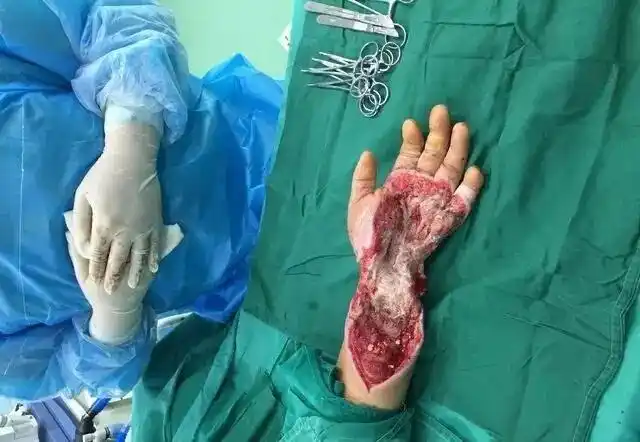 医生手机里珍藏的,都是哪些病例? - 知乎