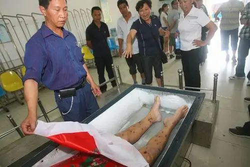 8月30日,湖北石首市殡仪馆内,姚俊开的遗体皮肤上有很多黑点和结痂.