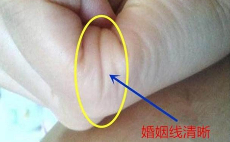 手中有三条婚姻线的人情感方面较为丰富,其思想开放,是一个多情之人.