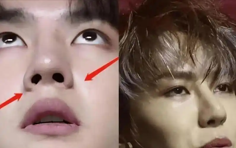 原创王一博新剧状态堪忧整容后遗症明显年代戏镜头里全暴露