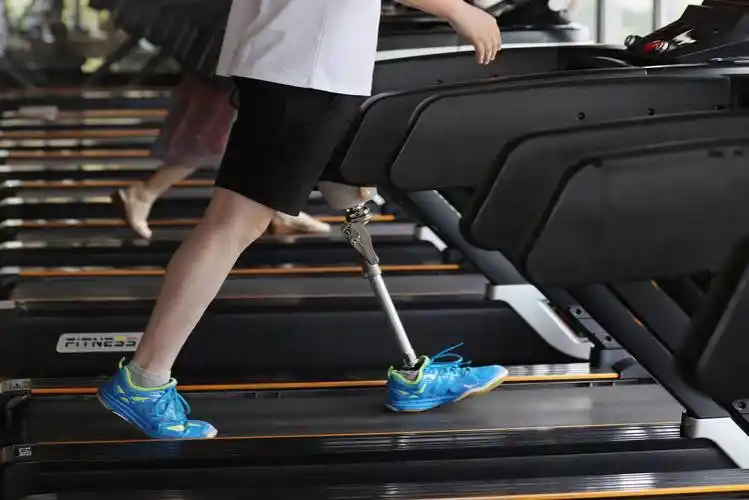 性能好的生活假肢或者是专业的运动假肢,作为一个大腿截肢的患者来说