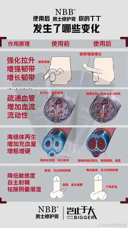 nbb修复膏男士修复硬度延长房事时间调理海绵体大小勃起困难早泄阳痿