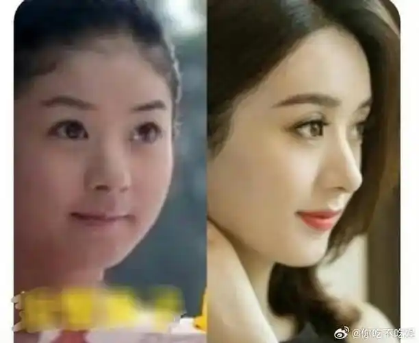 赵丽颖这鼻子变化还是挺明显的吧