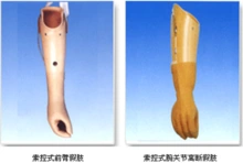 假肢
