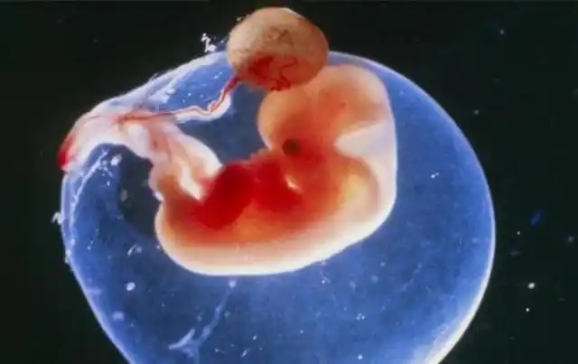 怀孕2个月,进入胎儿发育的"转折点",孕妇须注意4个问题