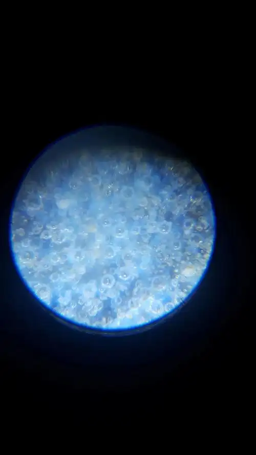 显微镜下看到的内在气泡